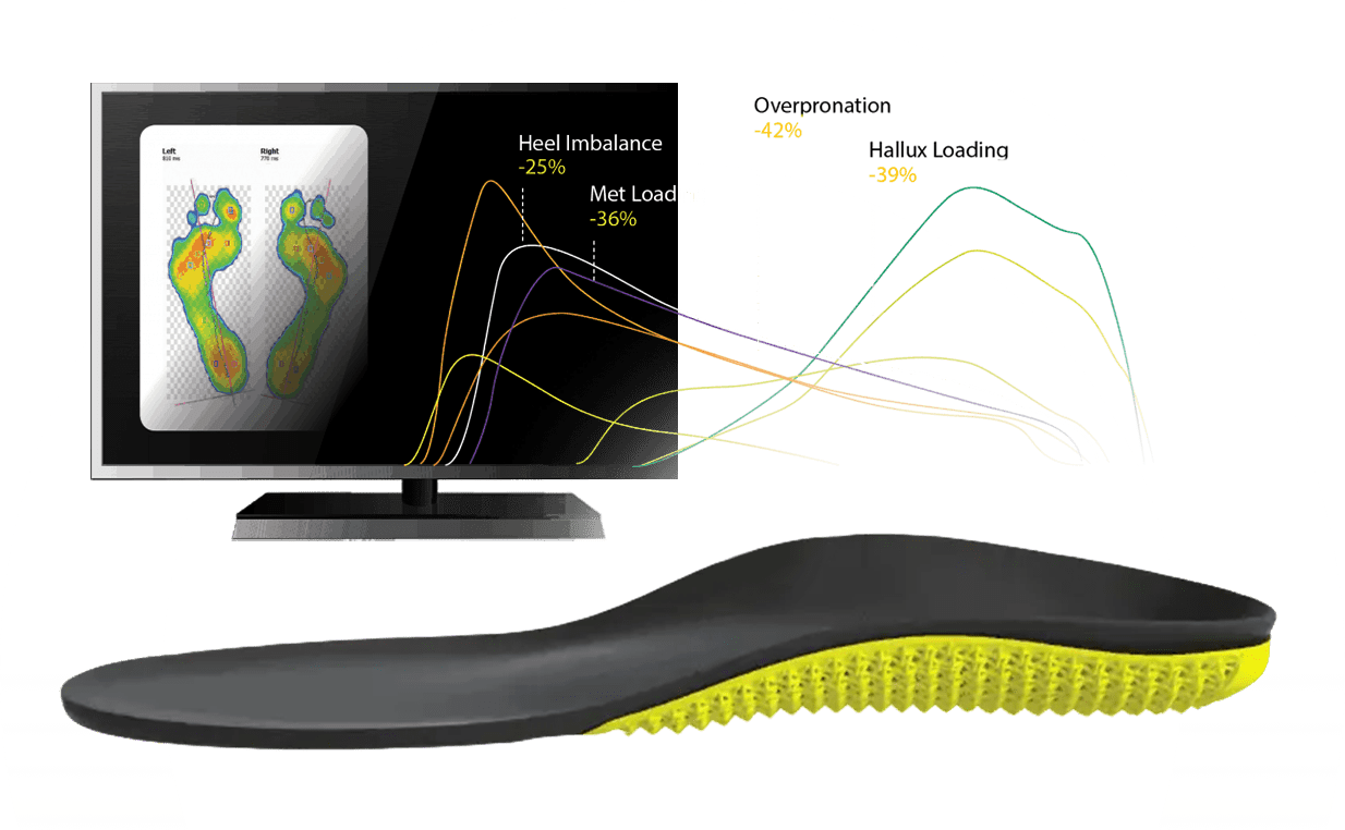 Orthotics Concord & Vaughan