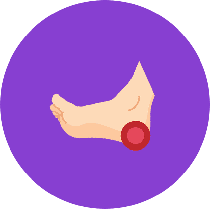 Orthotics Concord & Vaughan