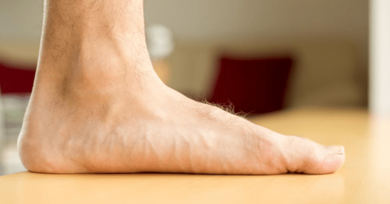 The Ultimate Guide to Foot Orthotics