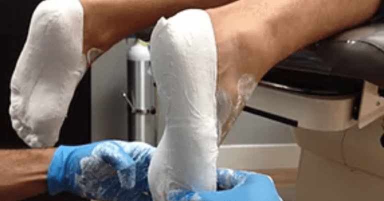 The Ultimate Guide to Foot Orthotics