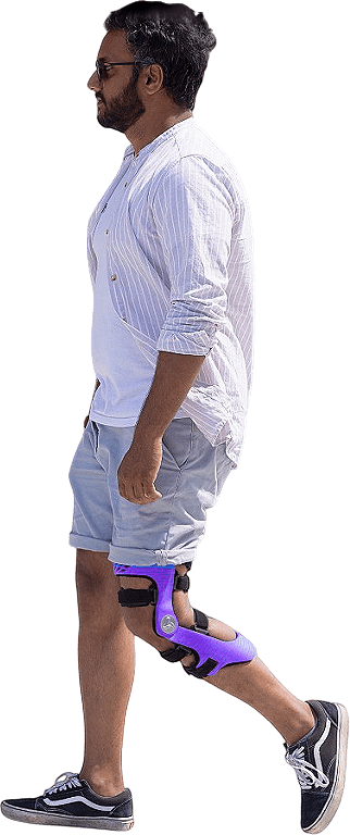 Custom 3D Printed Knee Braces in Barrie
